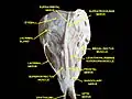 Superior view of a dissection of the left orbit. The frontal nerve can be seen dividing into the supratrochlear nerve, medially and the supraorbital nerve, laterally.