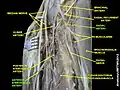 Anterior interosseous artery