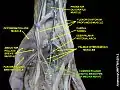 Common palmar digital branches of median nerve