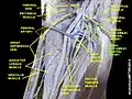 Medial circumflex femoral artery