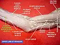 Flexor digitorum superficialis muscle