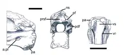 Vertebra