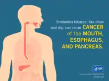 Graphic from the 2016 Centers for Disease Control and Prevention report entitled Smokeless Tobacco: Health Effects. The text states, "Smokeless tobacco, like chew and dip, can cause CANCER of the MOUTH, ESOPHAGUS, AND PANCREAS."