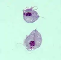 Two trophozoites of "Trichomonas vaginalis" stained with Giemsa