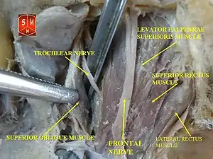 Lateral rectus muscle